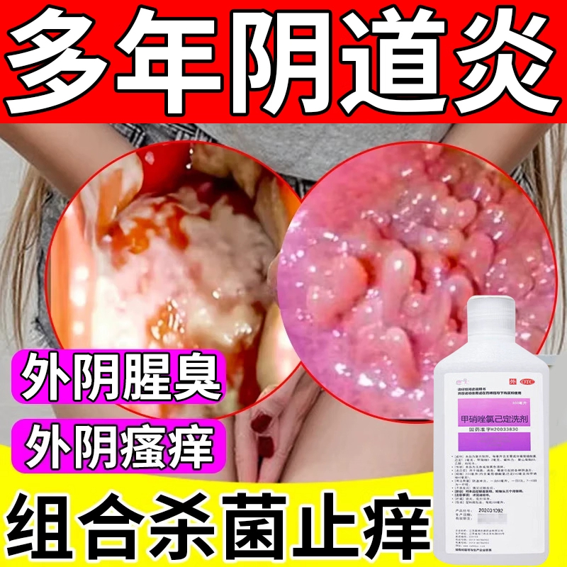 阴道炎妇科用药治疗霉菌性阴道炎妇科外阴瘙痒专用止痒阴道炎洗剂