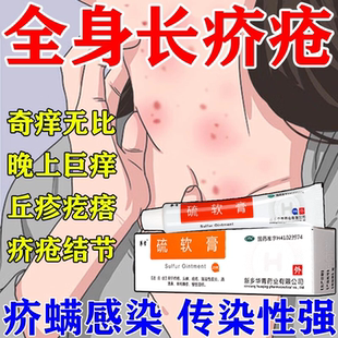 硫软膏正品治疥疮专用药膏疥疮结节阴囊结节疥螨虫瘙痒抑菌止痒药