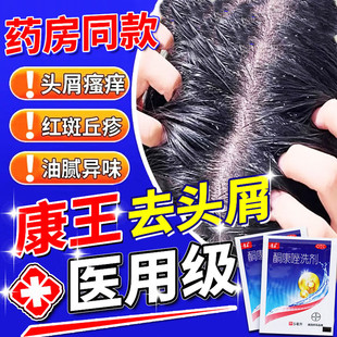 康王酮康唑洗剂头皮油脂糠疹头皮屑花斑癣脂溢性皮炎专用抑菌瘙痒