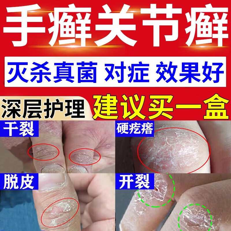 华佗膏正品杀菌治脚气止痒脱皮臭脚出汗脚气药膏癣症湿脚趾痒难受,OTC药品/国际医药,抗菌消炎,淘宝优惠券,粉丝福利购,淘宝优惠卷