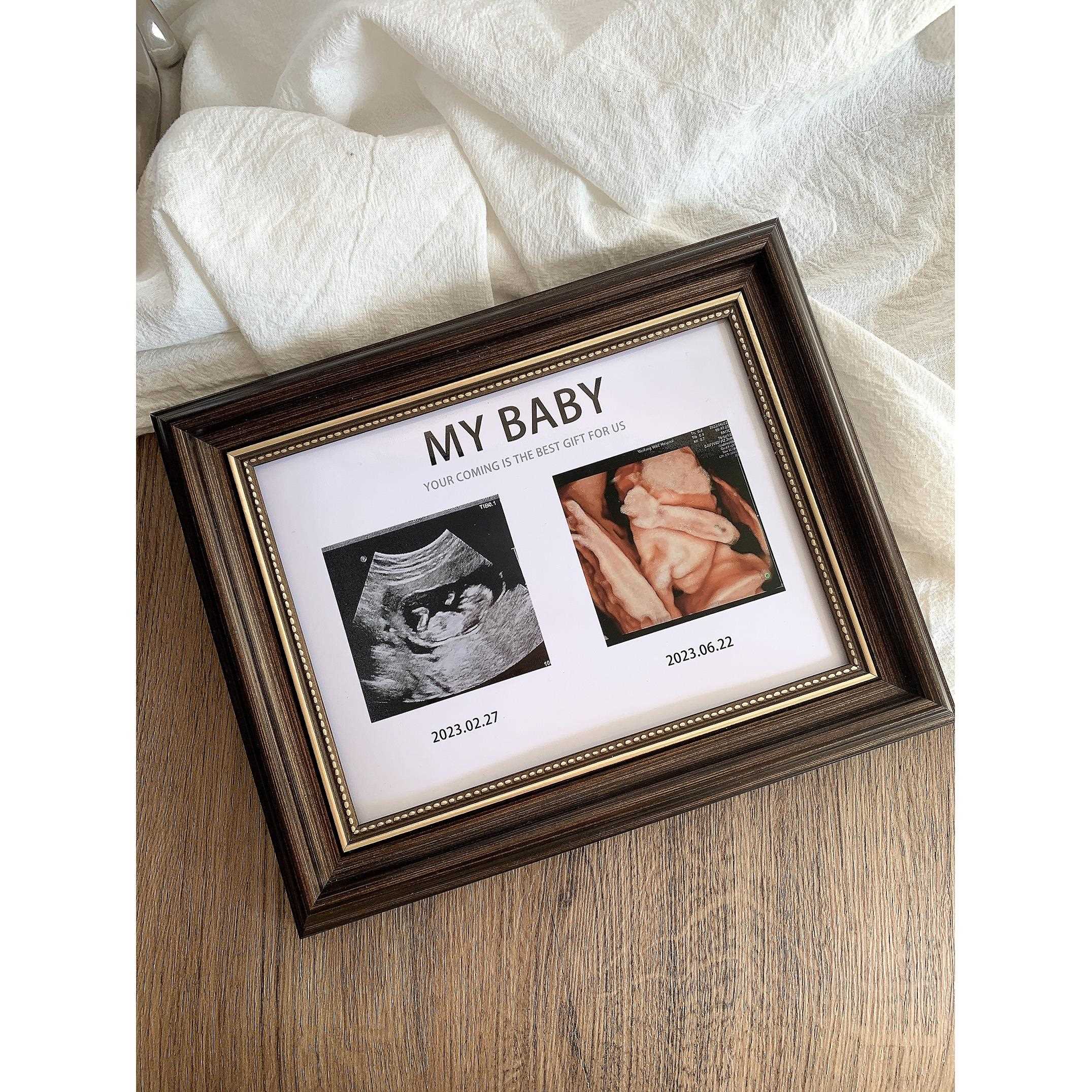宝宝四维照片相框孕期NT B超图打印婴儿出生礼物摆台纪念照