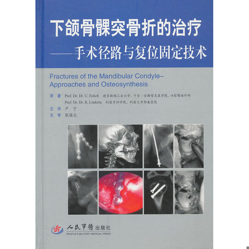 库存绝版书下颌骨髁突骨折的治疗：手术径路与复位固定技术 9787509170380 （德）埃克尔特,（德）洛克塔原著,严宁主译 人民军医出
