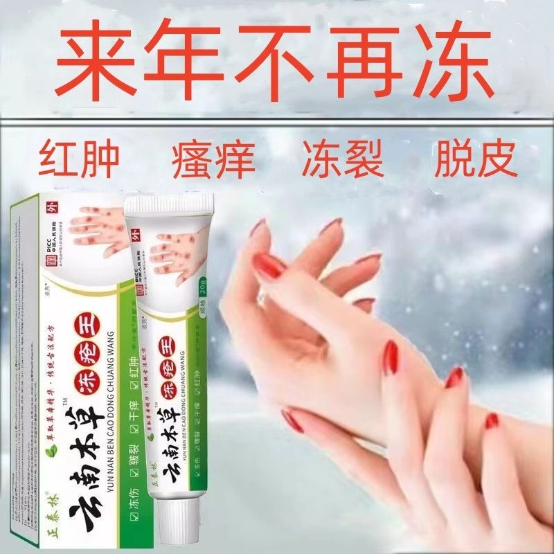 冻疮膏止痒伤特防裂儿童耳朵脸部