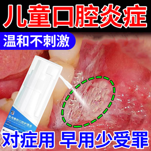 鹅口疮喷剂可搭碳酸氢钠广西上梨漱口喷非制霉菌素混悬液婴儿凝胶