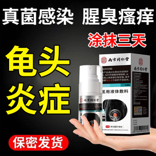 龟头炎症男性真菌感染包皮炎裂口冠状沟珍珠丘疹白垢阴囊瘙痒喷剂