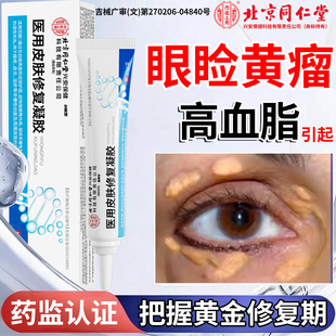 睑黄瘤去除神器眼睑黄瘤疣去眼皮黄斑瘤疣专用膏血脂高眼部脂肪粒