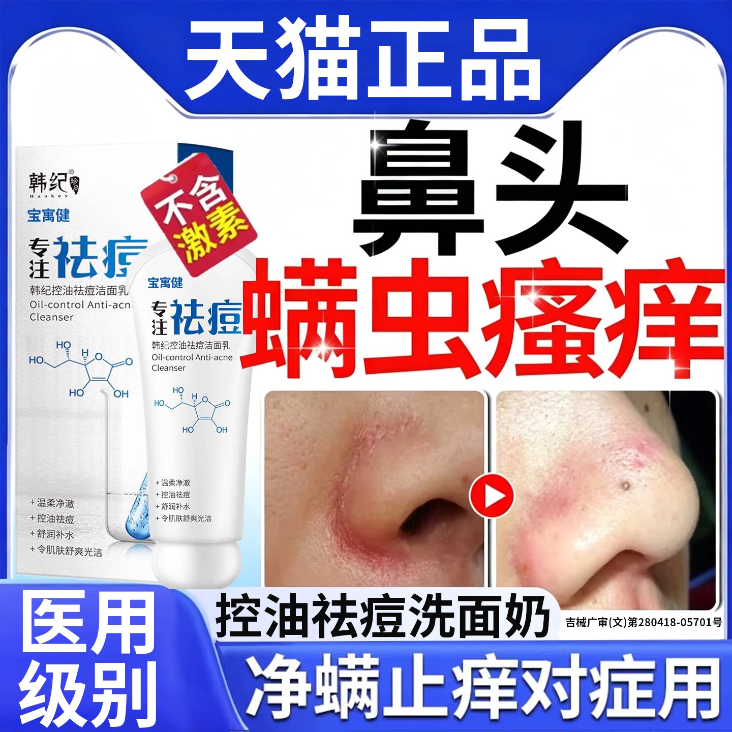 去鼻子螨虫脸部药膏脸上清洁洗面奶酒糟鼻头毛囊炎祛痘面部除螨虫