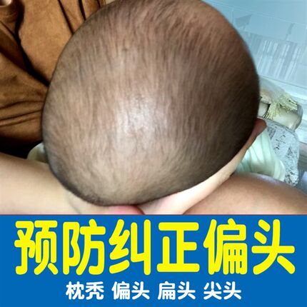 宝宝儿童矫纠正防偏头定型枕头新生初生婴儿0-1-2-3岁记忆枕小孩