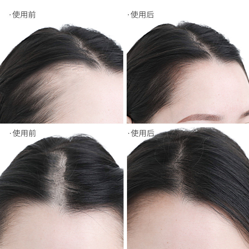发际线粉防水防汗头发稀少填充神器修饰大额头阴影粉自然遮高额头