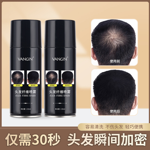 增加发量神器密发头发纤维粉喷雾补发缝盖白发一次性染色喷雾干胶
