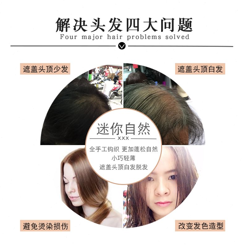 头顶补发头顶补发全真 无痕发假发片一片式遮白发迷你 蓬松片女