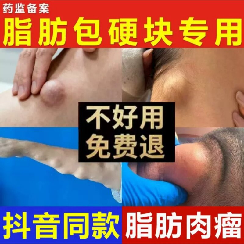 陈九玄医用聚乙二醇护创敷料顽固脂肪包硬块疙瘩皮下囊肿正品K5