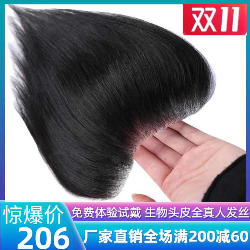 男女发际线前额补发片浏海假发贴全真人发高额头补发M型无痕隐形