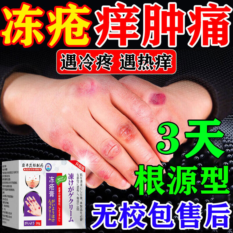 岩井昃弘冻疮膏手足防冻