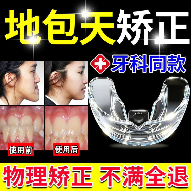 【热销款】地包天矫正器牙齿矫正