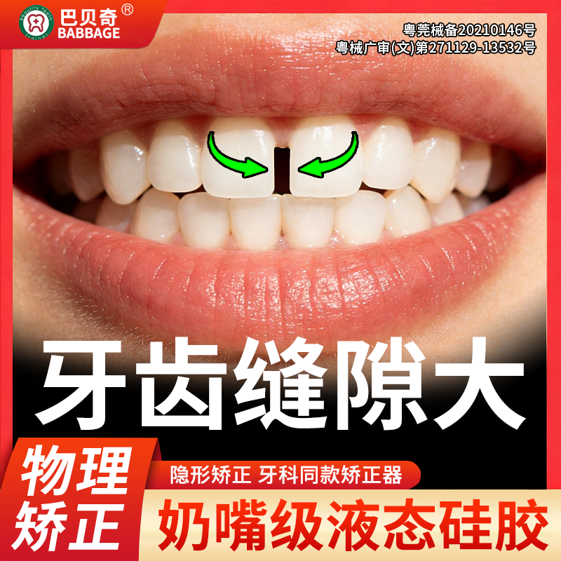 门牙缝宽大修复神器收紧牙齿缝隙缩小填充修补牙套贴片成人矫正器