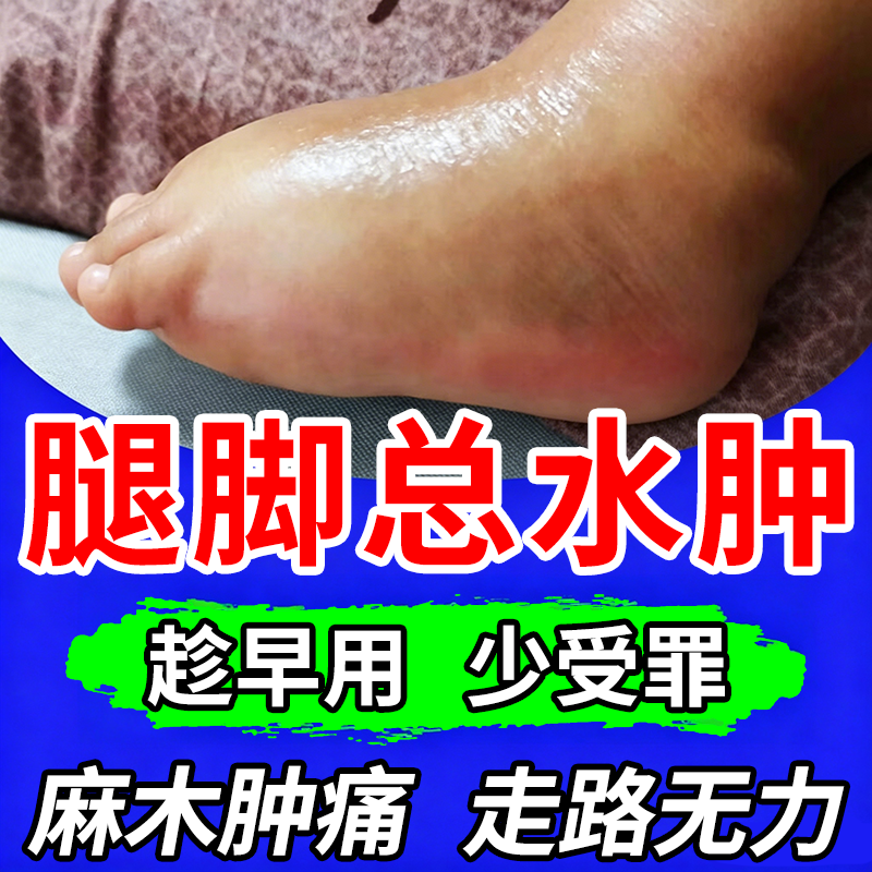 消肿去水肿专用老人脚肿消肿利水利尿排水肿去小腿下肢部浮肿神器