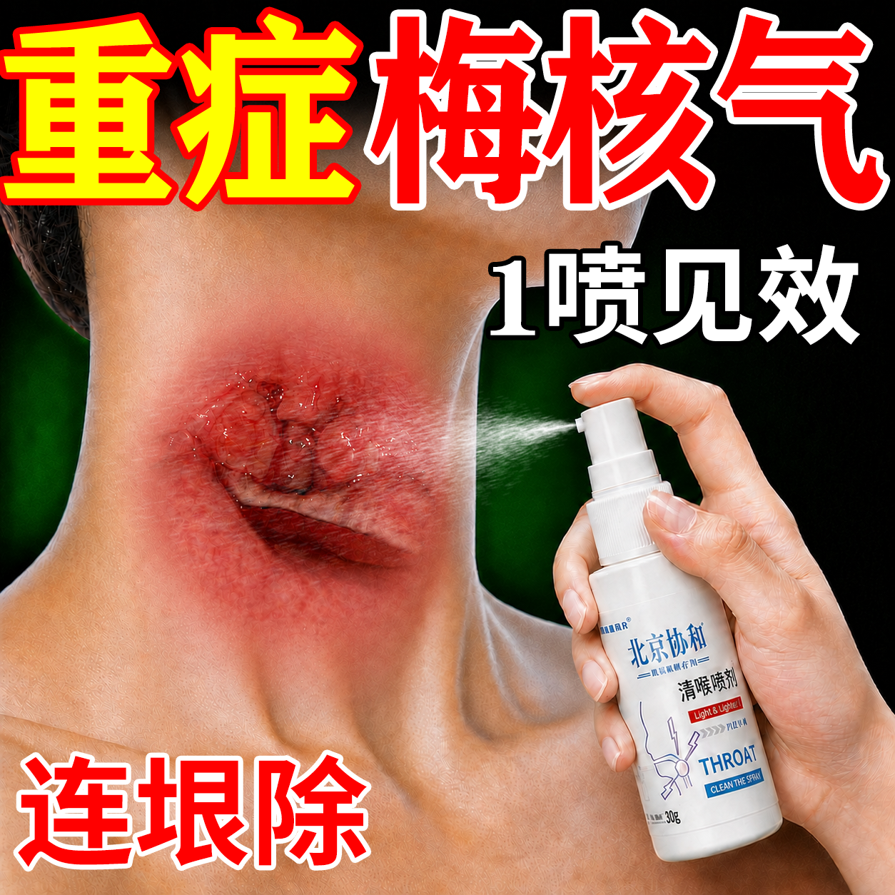 【喉咙异物】慢性咽炎溃疡喷雾剂