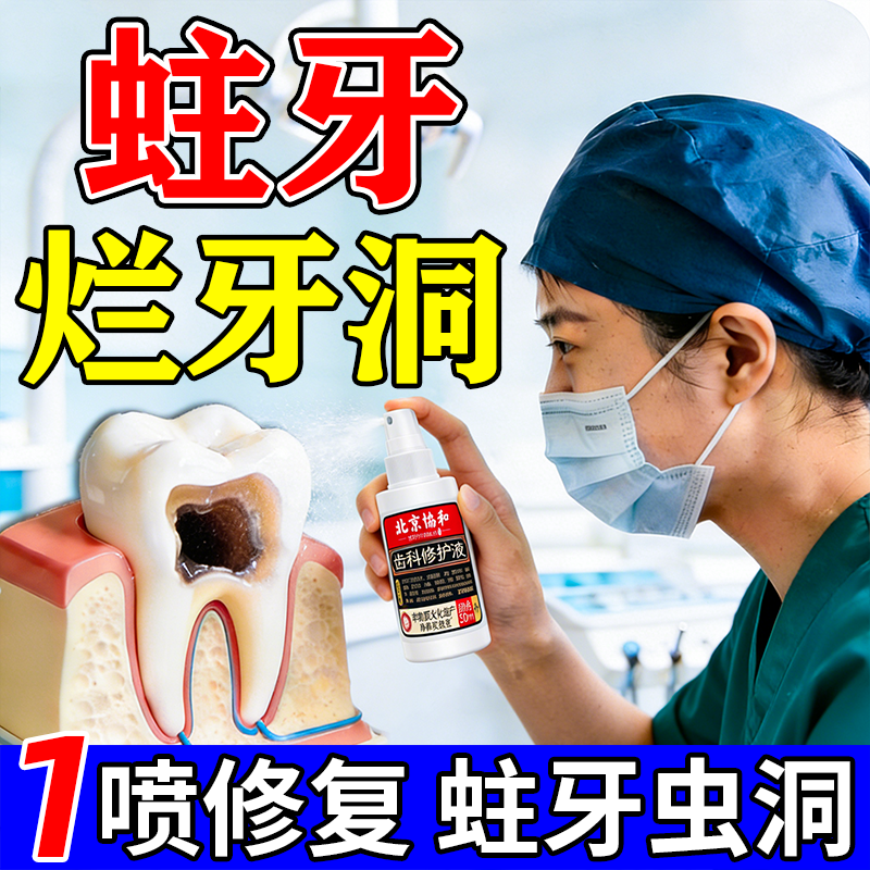 补牙材料永久医用神器补牙齿烂洞修复液树脂膏补牙缝自瓷粉己填充