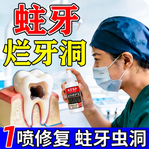 补牙材料永久医用神器补牙齿烂洞修复液树脂膏补牙缝自瓷粉己填充