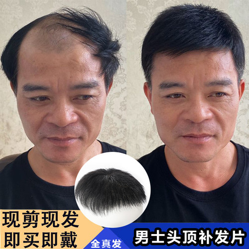 男士全真发无痕隐形补发片