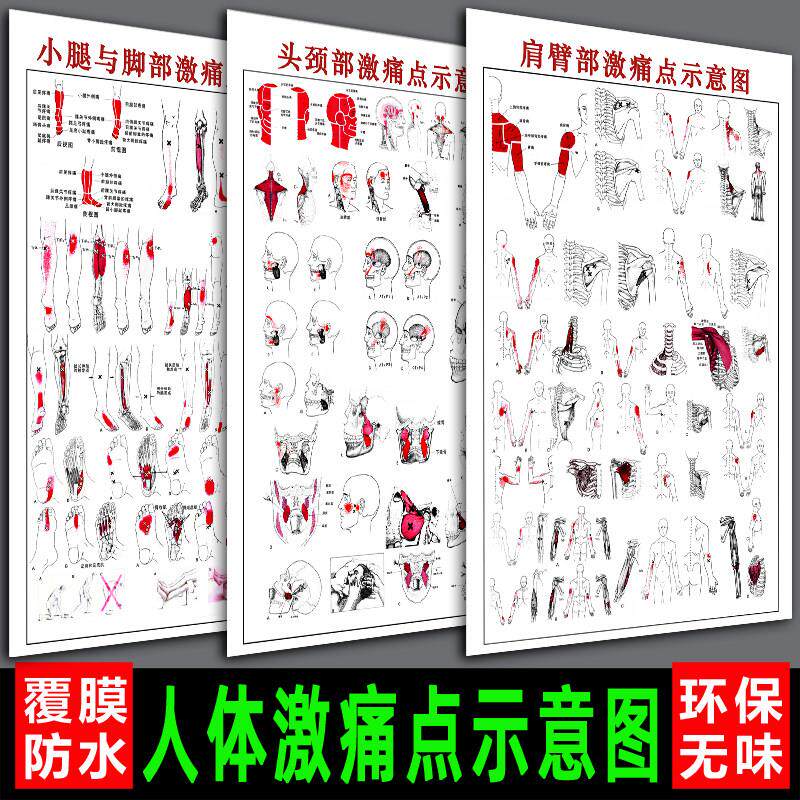 医院人体肩臂部激痛点示意图前臂手部头颈脚躯干髋与大腿小腿挂图