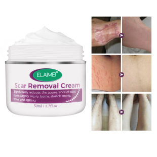 50ML Effectivel Scar Removal Cream Advanced Treatment Face a