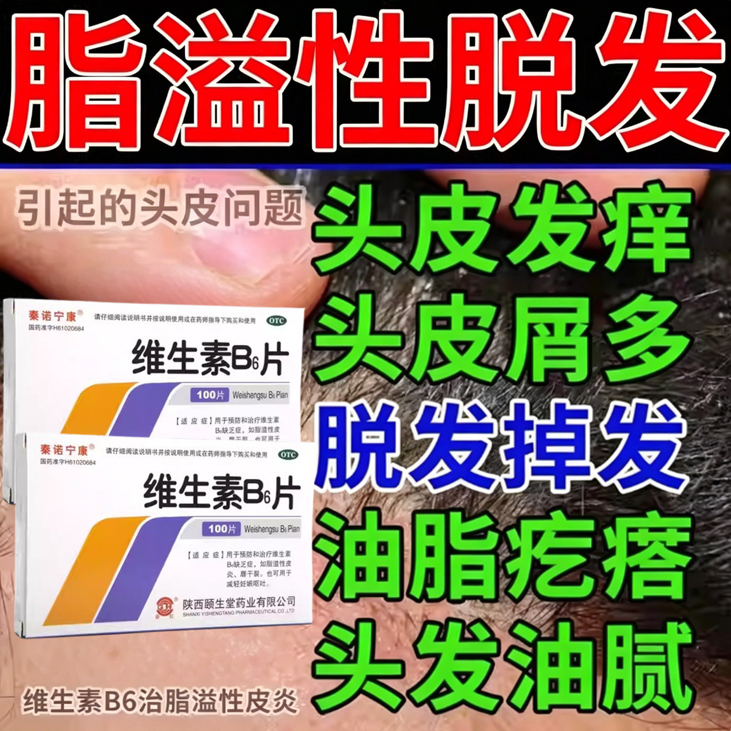 维生素B6脂溢性皮炎引起的严重脱发头发油红斑头皮屑瘙痒营养不足