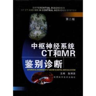 【正版书籍】 中枢神经系统CT和MR鉴别诊断 鱼博浪 陕西科学技术出版社