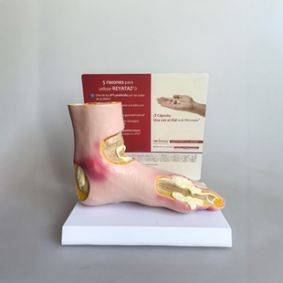 人体解剖模型，医学教学模型 ，足病理模型