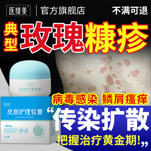 玫瑰糠疹专用皮肤瘙痒药监备案红斑鳞屑根膏药贴搭沐浴露除YG