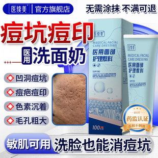 脸上痘印痘坑修复肌肤男士女士医用型祛除凹洞生长因子洗面奶YF