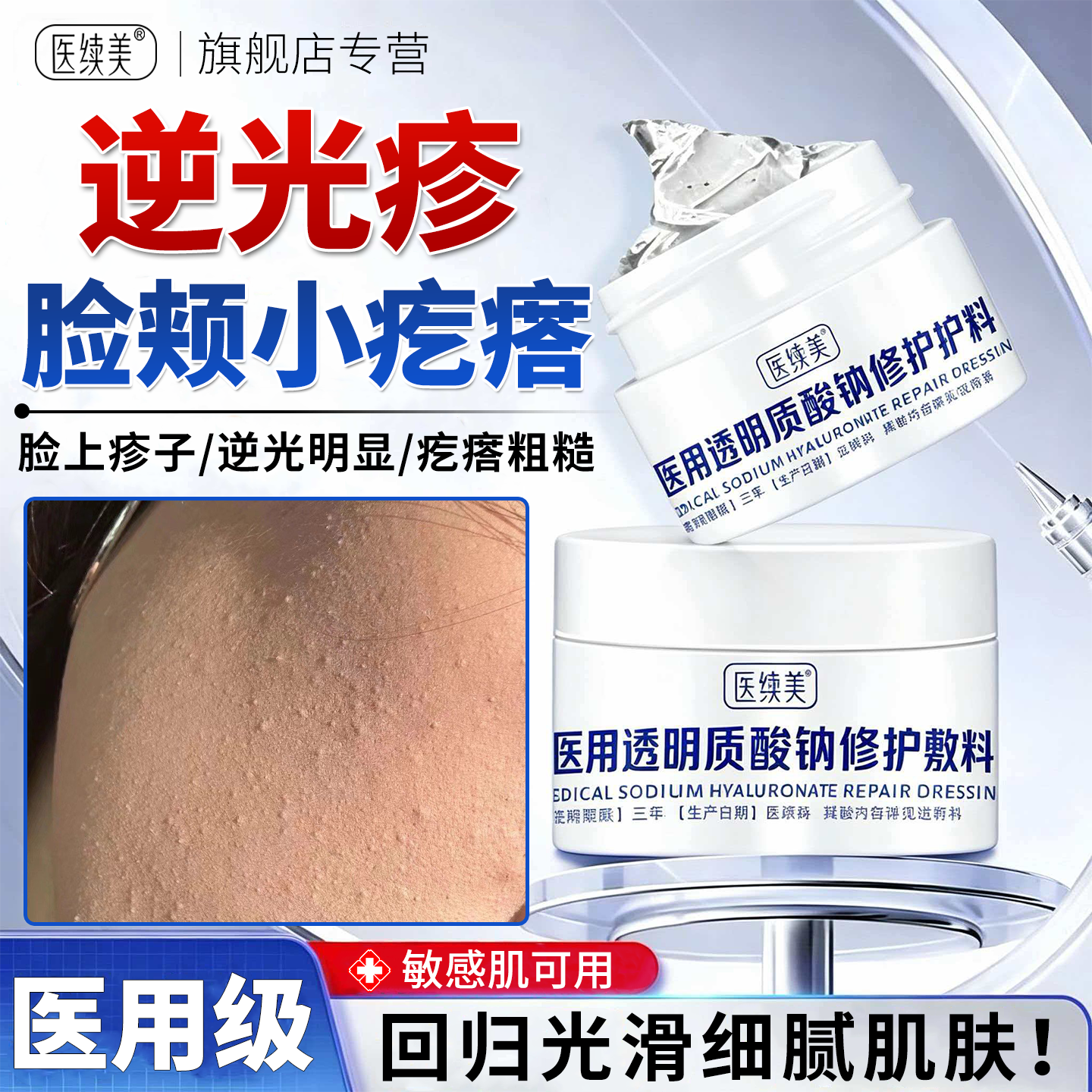 逆光疹修复脸上起小疙瘩屏障修复儿童去粉刺闭口脂肪粒清洁毛孔QN