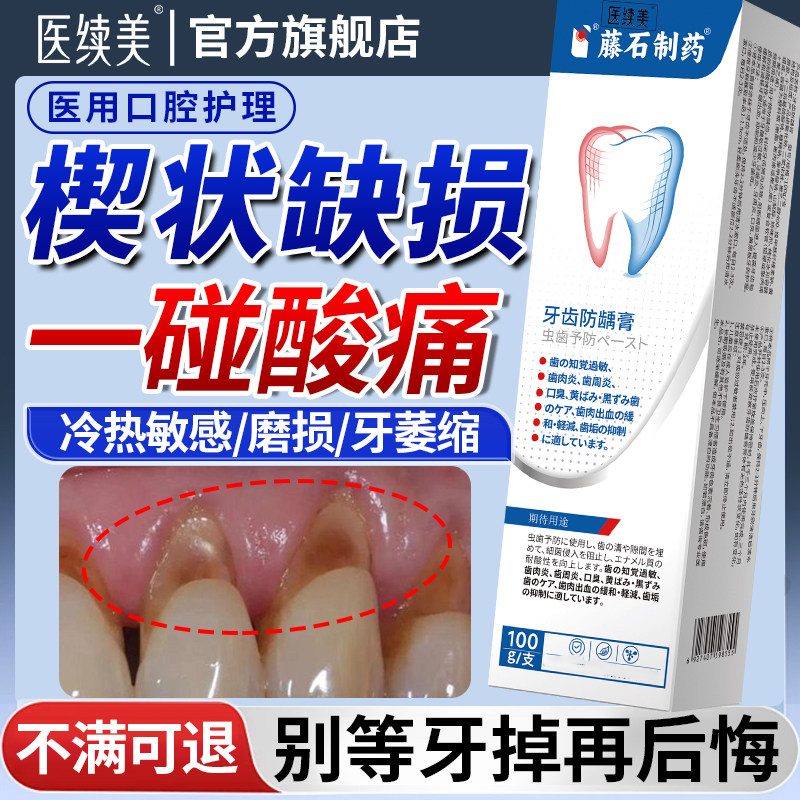 牙齿楔状缺损修补敏感酸痛牙龈牙釉质修复牙根腐蚀专用可搭牙膏QN