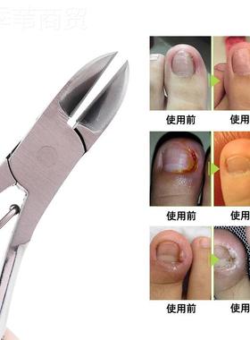 不锈钢花纹20229柄死皮刺剪 便携式皮钳去倒灰指甲死死皮刀美甲钳