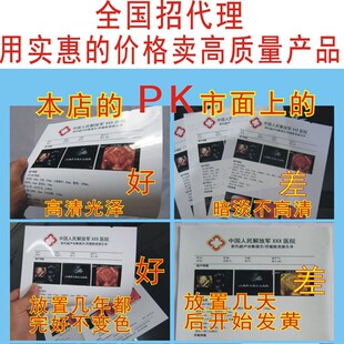 医院用胶片瓷白喷墨片胶片胶片胃镜超四维彩超打印纸张