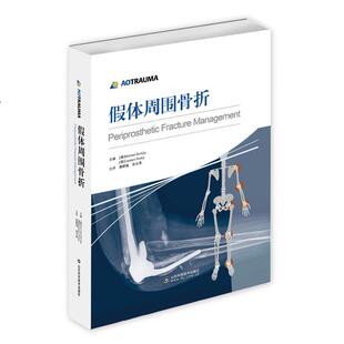 【正版书籍】 假体周围骨折 (澳)舒茨,(德)帕卡　主编,唐佩福,张立海　译 山东科学技术出版社