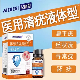 扁平疣寻常疣丝状疣脖子腋下正品尤瘊净跖疣瘊子肉粒疣瘊非乳膏