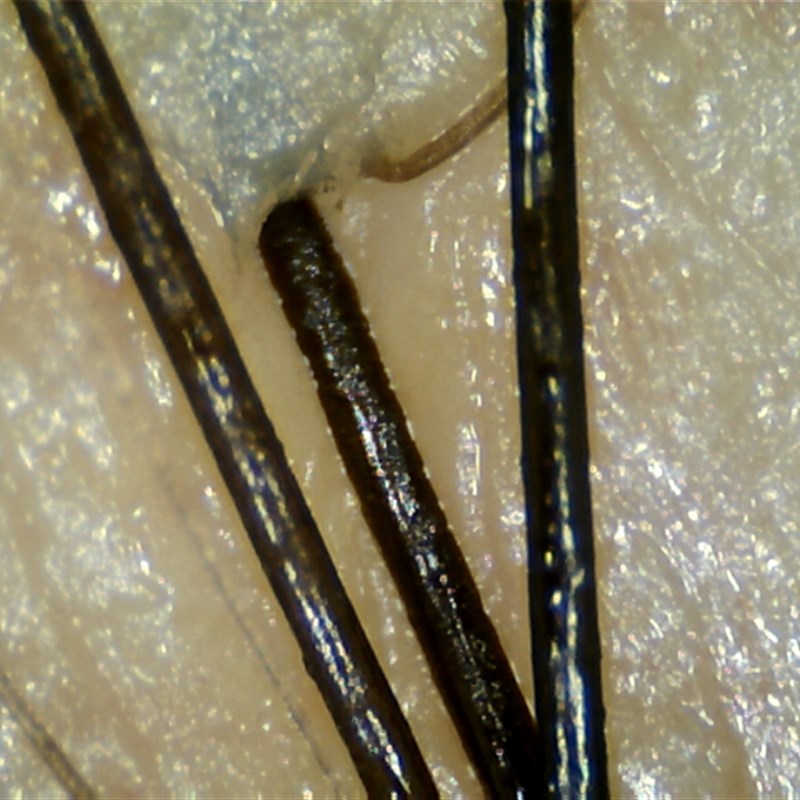 200倍毛发g镜头 毛囊镜头 头皮镜头 发质镜头 自动分析镜头