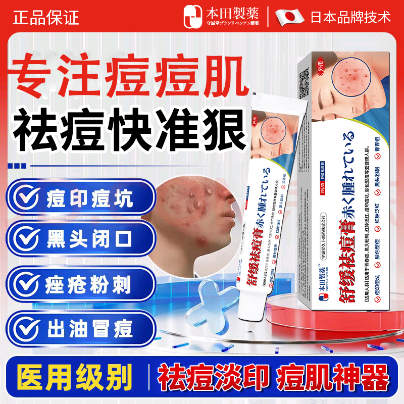 本田祛痘药膏祛痘淡化痘印痘坑
