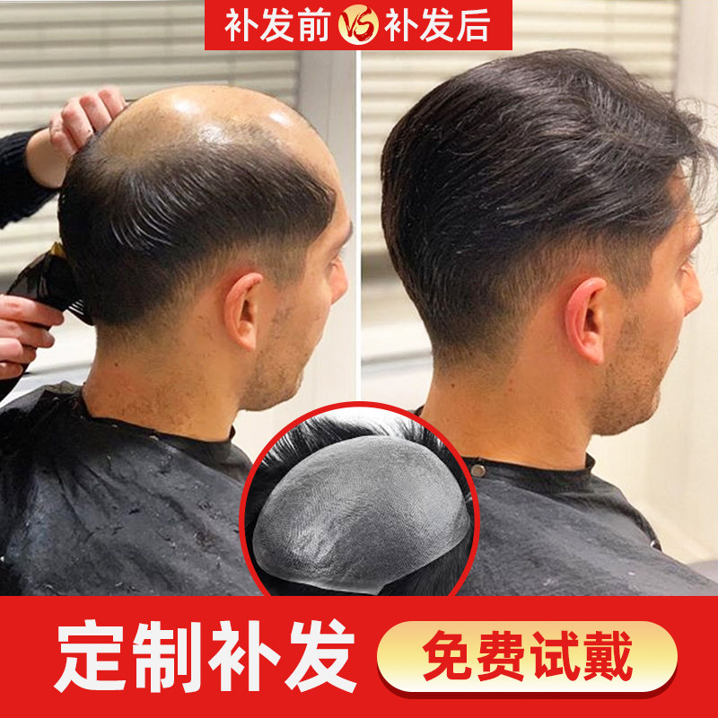 木极客补发假发片男前额头发际线假发贴前额男P生隐形短发韩版帅