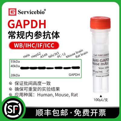 赛维尔 GAPDH 常规WB内参抗体 小鼠/兔mAb 重组抗体 需孵二抗