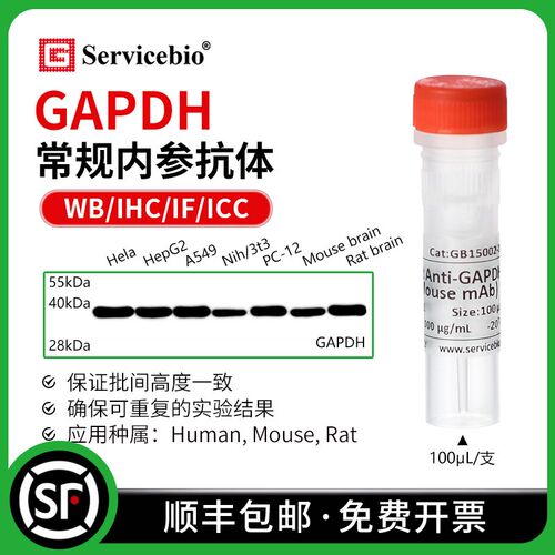 赛维尔 GAPDH 常规WB内参抗体 小鼠/兔mAb 重组抗体 需孵二抗