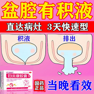 盆腔积液吃什么药附件炎慢性盆腔炎消炎药中成妇科用药妇炎康胶囊