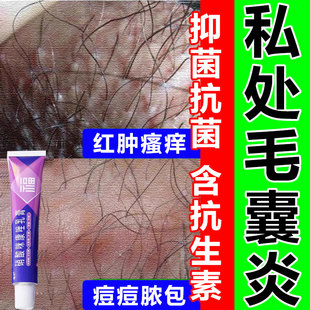 毛囊炎药膏私处消炎止痒抑菌治真菌感染外阴瘙痒有小疙瘩痘痘脓包