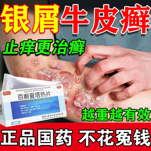 【济仁】百癣夏塔热片0.31g*36片/盒