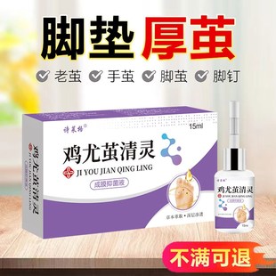 老茧去除软化剂祛手部角质死皮茧子治脚底脚垫的药去脚钉根专用膏