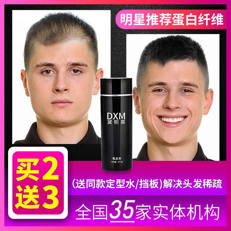 密发增发纤维头发粉喷雾神器补发量增多发际线填充头顶稀少秃假发