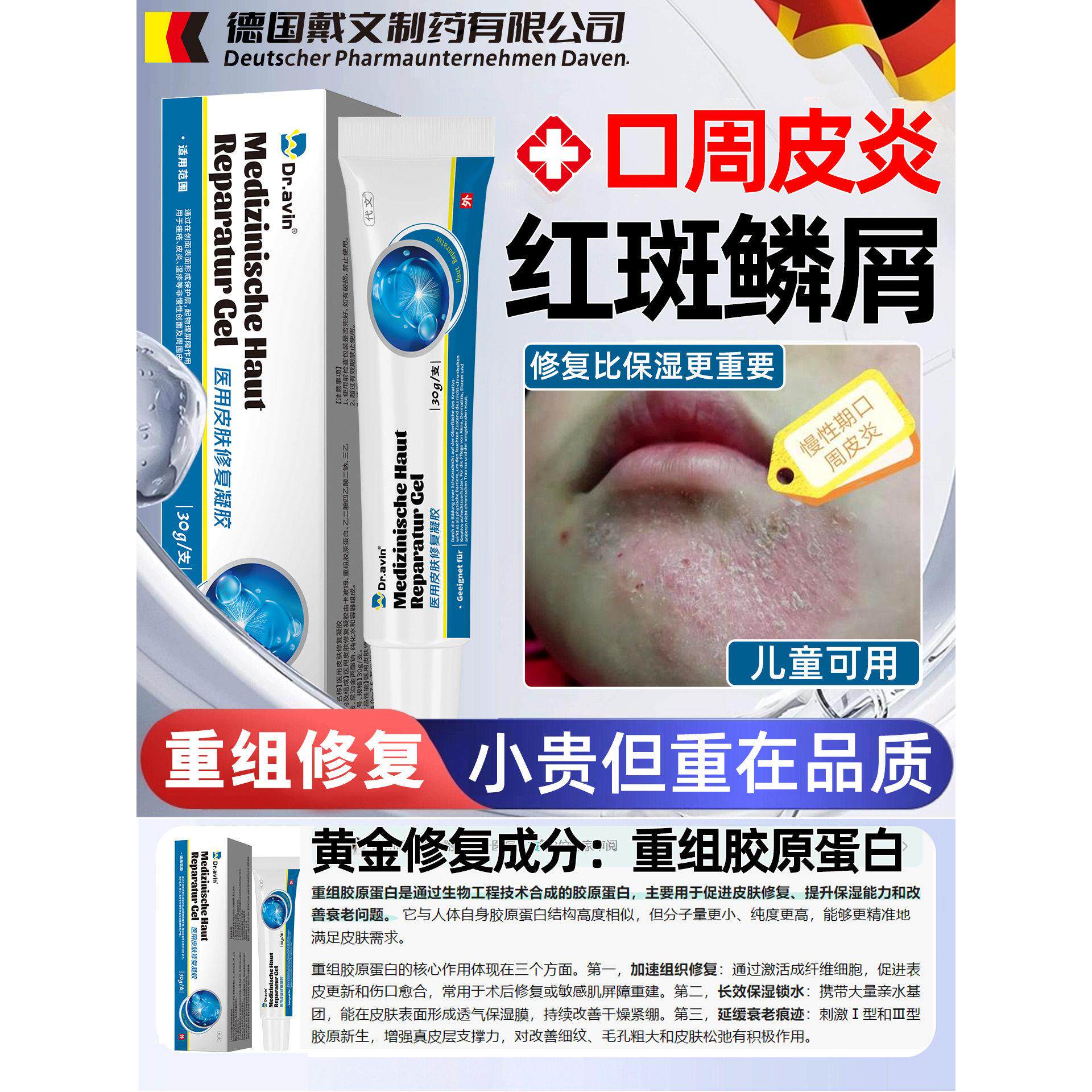 口周皮炎嘴角干燥起皮开裂口角炎脸上干燥有碎屑脂溢性皮炎面部SY