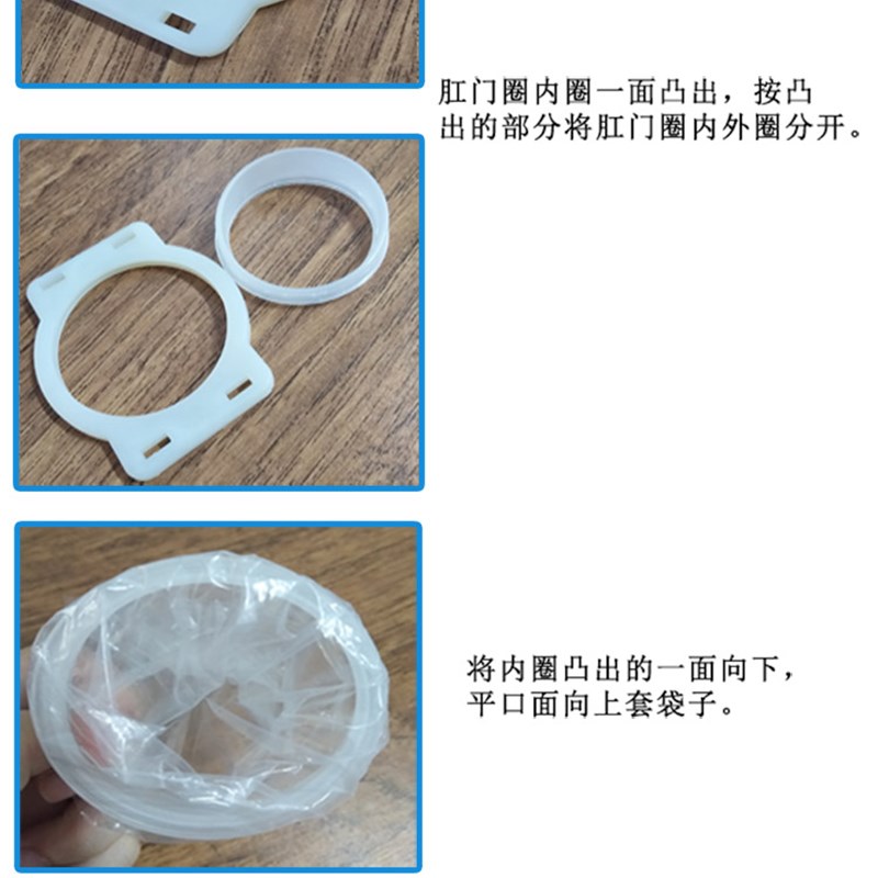 大桥牌 肛门圈袋带100个便袋 假肛接便器 人工肛门袋术后造口袋